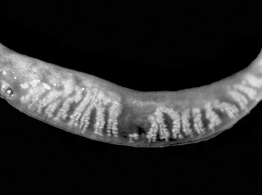 Image des glandes de Meibomius sous transillumination adaptative